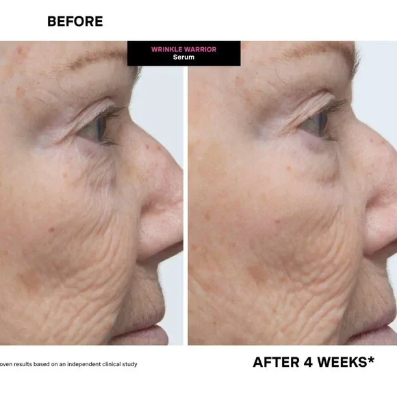 Kate Somerville - Wrinkle Warrior® 2-in-1 Plumping Moisturizer + Serum